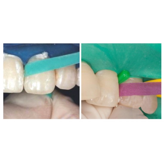 Dental Resin Polishing Strips
